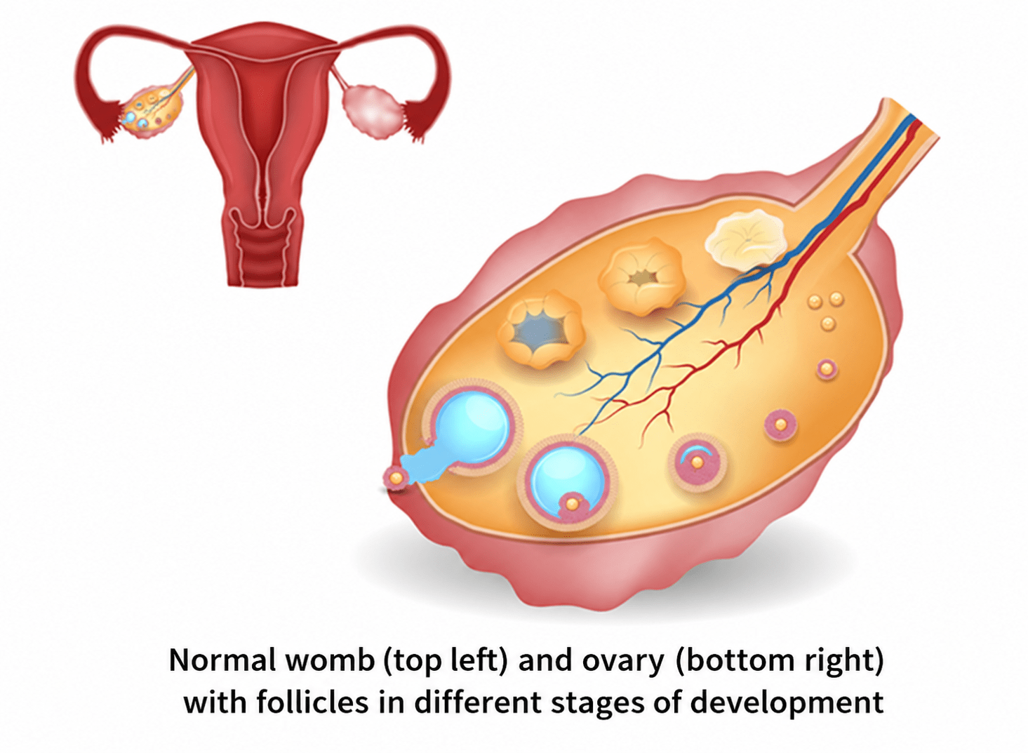 Diagram showing the anatomy of the womb and ovary